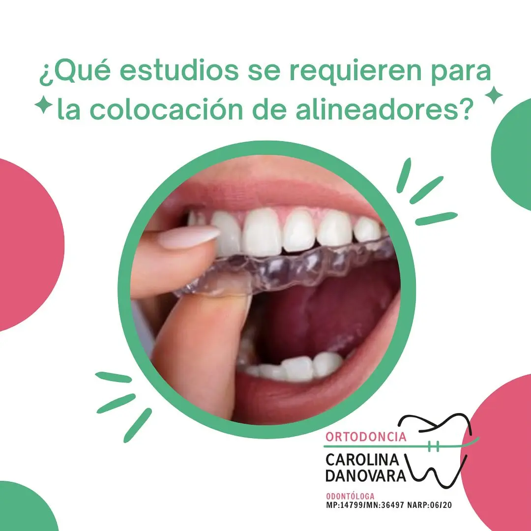 Proceso del Tratamiento