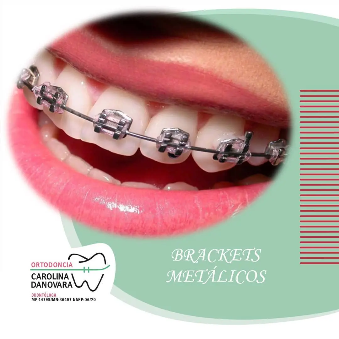 Brackets Metálicos